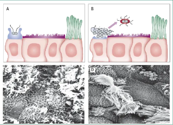 Figura 1. Infezione  di N. meningitidis (A), adesione del batterio (B), formazione di  microcolonie (C), colonizzazione della mucosa nasofaringea (D) (Lancet  2007,369:2196-210)
