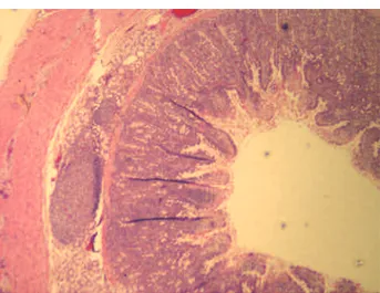 Figure 3. Duodenum with lymphoid follicles.