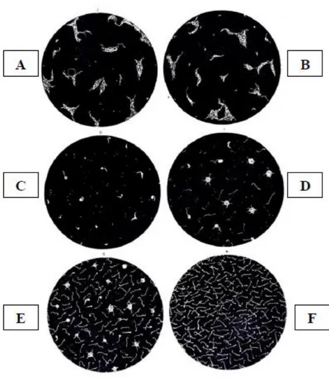 Figura  7:  Immagini  al  microscopio  ottico  in  campo  scuro.  Diverse  reattività  al  test  di  microagglutinazione  (MAT):  reazioni  positive  decrescenti  a  partire  da  agglutinazione  al  100%  (A)  fino ad arrivare ad assenza di agglutinazione 