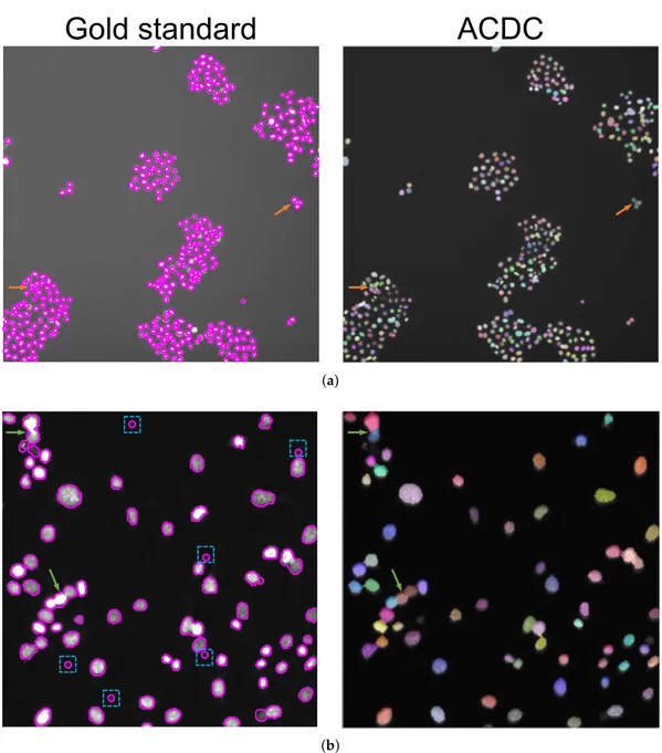 Figure 8. Comparison of the gold standard cell nuclei segmentation (magenta contour in the left images) against the automated result obtained by ACDC (segmented nuclei over-imposed onto the original fluorescence images with alpha-blending in the right imag