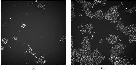 Figure 1. (a,b) Examples of the analyzed microscopy fluorescence images provided by the Department of Biochemistry of the VU