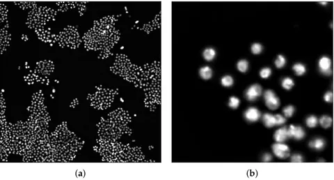Figure 5. Result of the application of the pre-processing steps on the images shown in Figure 1b (a) and Figure 2a (b).