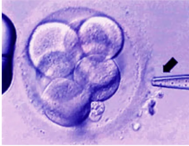 Fig. 3.1 Hatching della Zona Pellucida (AZH).