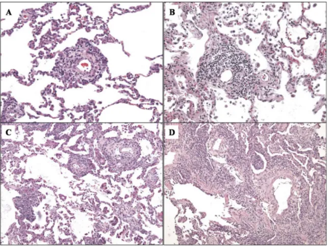 Figure 1.1 Emblematic cases of parenchymal acute rejection graded as A1 (A), A2 (B), A3 (C) and  A4 (D)