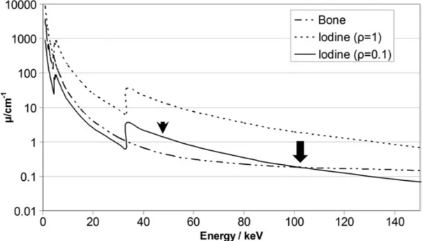 Fig. 1. Grafico dei coefficienti di attenuazione lineare per l'osso (supponendo r = 1 g / cm3), iodio (supponendo  r  =  1  g  /  cm3)  e  iodio  con  densità  inferiore  (supponendo  r  =  0,1  g  /  cm3)  in  funzione  dell'energia  (in  kiloelettronvolt