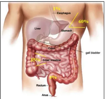 Figure 1. GISTs may be found anywhere in or near the  GI tract