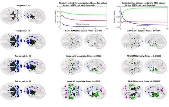 Figure S2: Glass brain rendering of theoretical AND-predicted regional τ distribution seeded at the putamen (left column) and its comparison with empirical τ measured from regional AV1451-PET scans of patients (middle column) and regional atrophy obtained 