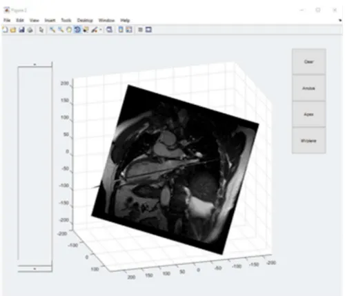 Figure 5 Three-dimensional rendering of 2-Chamber and 4-Chamber views of the heart  for the selection of anatomical landmarks 