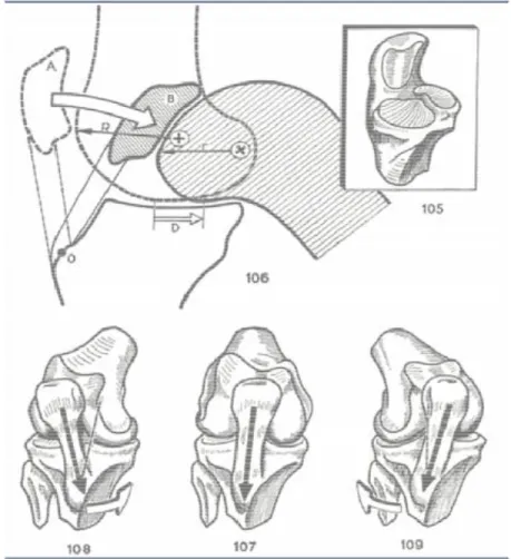 Figura 3 Posizionamento della rotula nei vari movimenti del  ginocchio. 