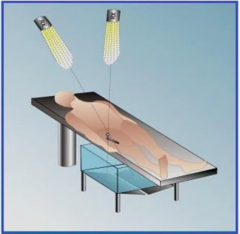Figura 7 Sistema uniplanare applicato per lo studio della protesi d’anca 