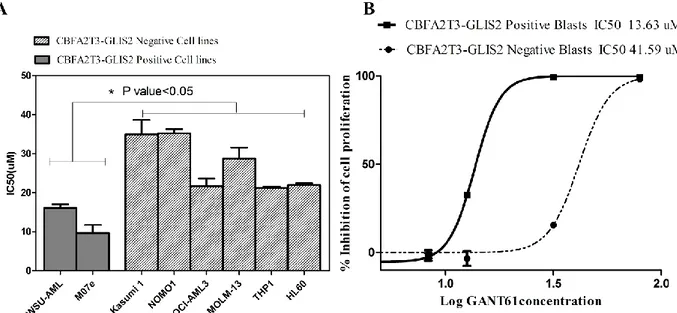 Figure 6. A) IC50 of  CBFA2T3-GLIS2 and  negative cell lines 72h after  GANT61 exposure,  B Dose-response curves  after 72h of GANT61 treatment of primary cells derived from patients with acute myeloid leukemia either positive or  negative for CBFA2T3-GLIS