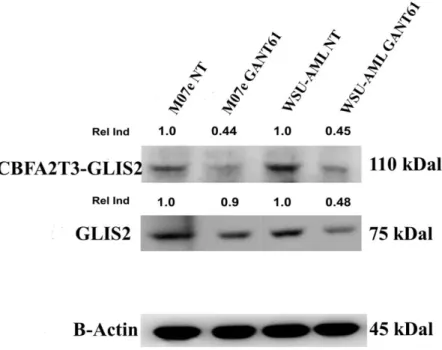 Figure  9.    Western  blot  analysis  showing  the  decrease  of  GLIS2  protein  and  CBFA2T3-GLIS  chimeric  protein  in  samples treated with 20 µM Gant61