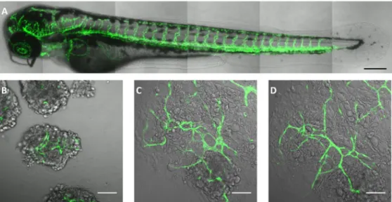 Figura  8:  Imaging  di  zebrafish  transgenico:  A-  intero  embrione  in  cui  si  evidenzia  la  rete  vascolare fluorescente formata dall’ unione delle cellule endoteliali marcate 