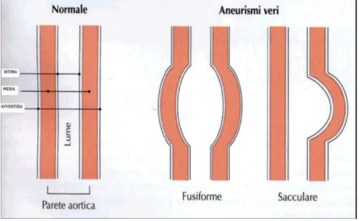 Fig. 4 Differenti aspetti della parete aortica 