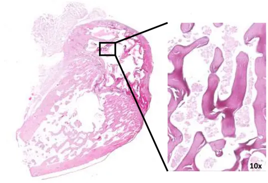 Figure 3.5: Histological image of femoral condyle after 14 days of culture. In detail, bone  trabeculae and bone marrow