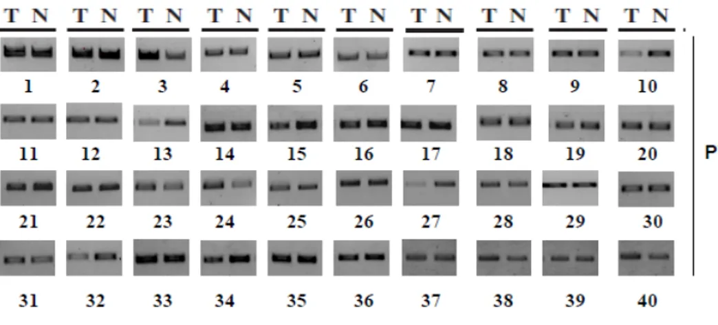 Figure  9  PCR analysis of PWN sequence in iCCA samples.   
