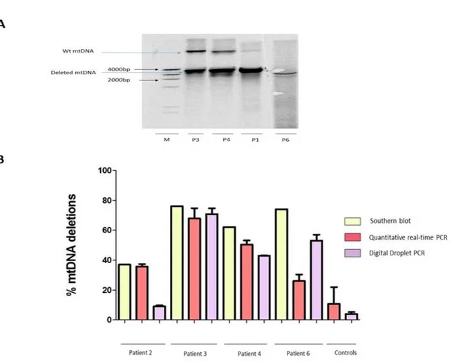 Figure  9.  MtDNA  deletions  heteroplasmy  levels.  (A)  Representative  image  for  Southern  blot