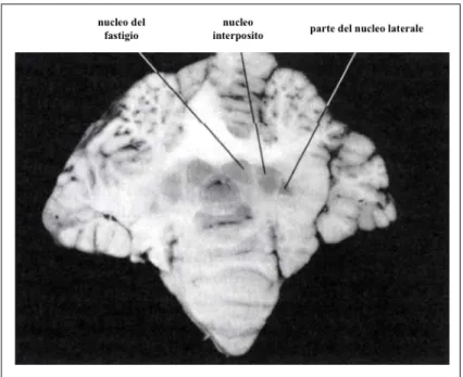 Figura 4. Sezione trasversale di cervelletto di bovino. Si evidenzia la topografia dei nuclei  cerebellari