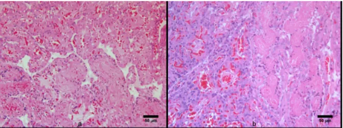 Fig  a e b: Lobuli coinvolti da necrisi coagulativa ( Infato) 