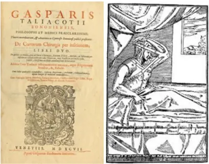 Figura  I.1. Frontespizio  (sinistra)  e un’immagine Tratta dal trattato “De curtorum chirurgia per  insitionem” di Gaspare Tagliacozzi 