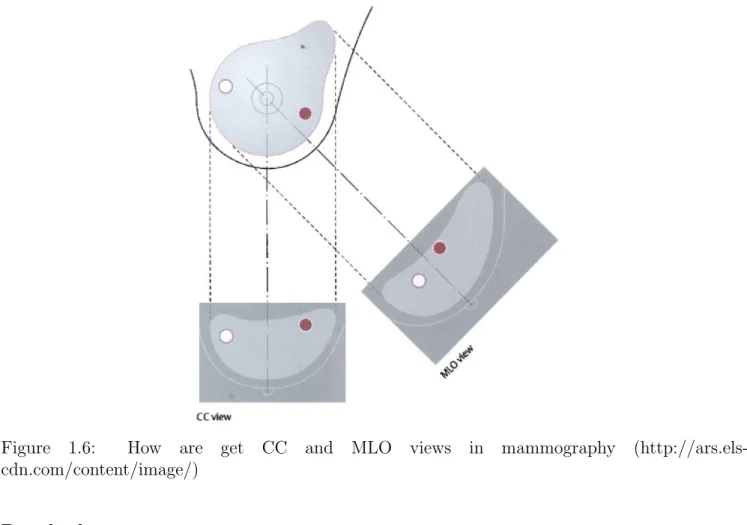 Figure 1.6: How are get CC and MLO views in mammography (http://ars.els- (http://ars.els-cdn.com/content/image/)