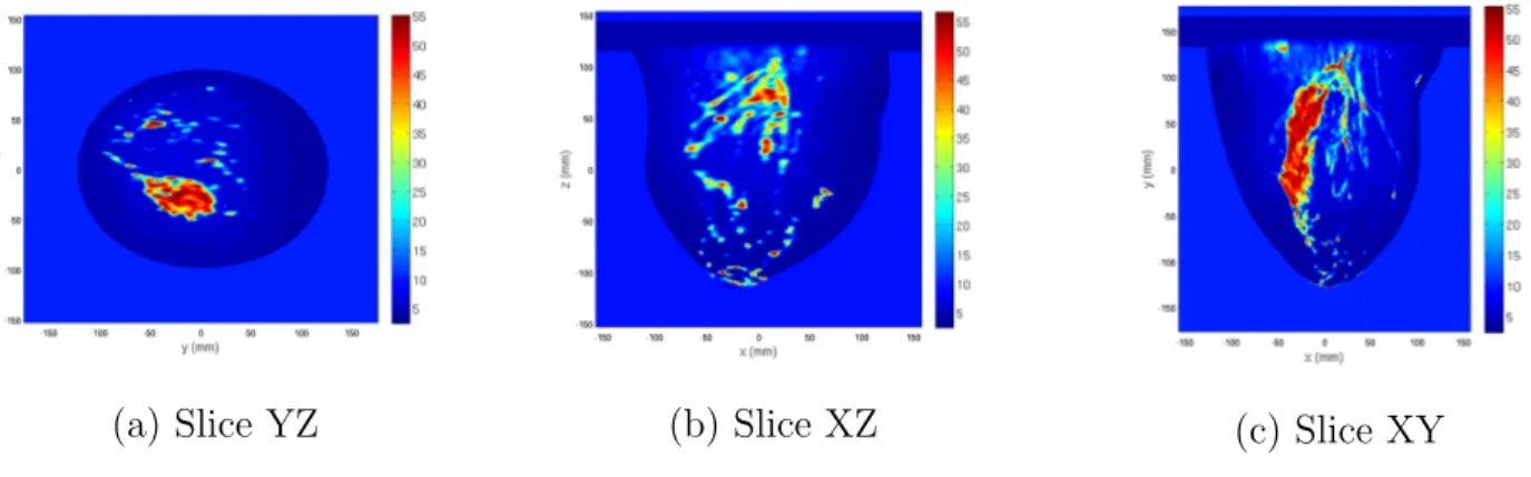 Figure 4.15: Epsilon slice for a patient with classification ACR 2 for an illumination frequency of 3 GHz