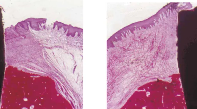 Fig. 2 e 3: Si osservano fibre collagene della mucosa perimplantare che decorrono con andamento  variabile e, in prossimità della superficie implantare, assumono un andamento parallelo ad essa