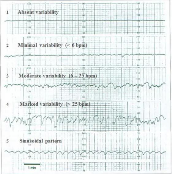 Figure 3.4 - Types of variability. Source: Medical Quick Review of Basics. Obstetrics [Online]