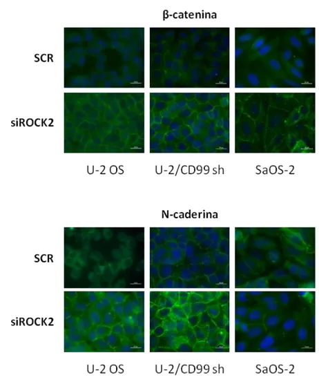 FIGURA 5.  ROCK2  modula  la  capacità  di  adesione  omotipica.  (A)  Effetti  dell’inibitore  specifico per ROCK2 (10 µM) sulla capacità di aggregazione omotipica sulla linea cellulare U2  OS e sui cloni derivati