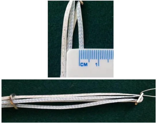 Fig  9.  Impianto  TightRope  (TR).  In  alto  particolare  del  materiale  di  sutura  FiberTape  (FT)  e  in  basso immagine dell’impianto TR con in evidenza i due bottoni in titanio