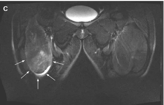 Figure 3 (Guerrero M. et al., 2008). Magnetic resonance image from a coronal view  of  the  anterior  side  of  the  thigh