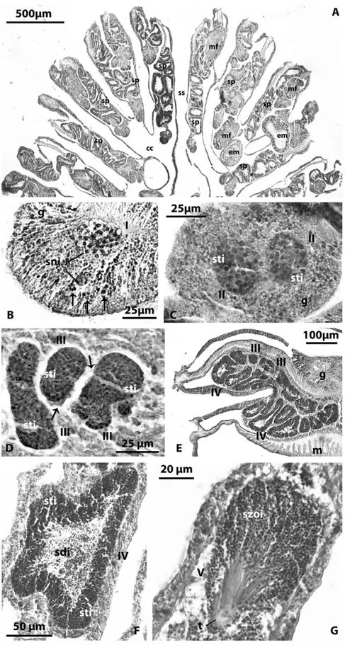 Fig. 3. Caryophyllia inornata. Spermatogenesis. A: Localization of the spermaries in the mesenterial septa