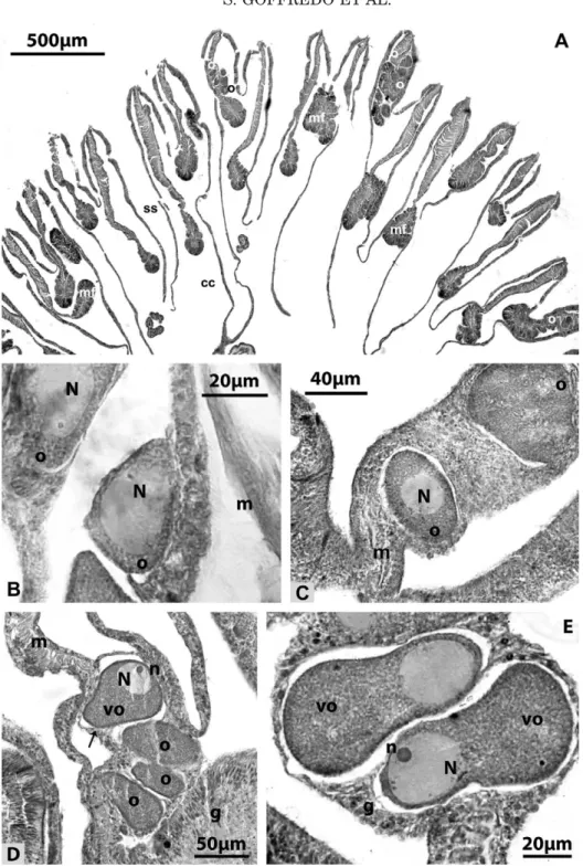 Fig. 4. Caryophyllia inornata. Oogenesis. A: Localization of the oocytes in the mesenterial septa