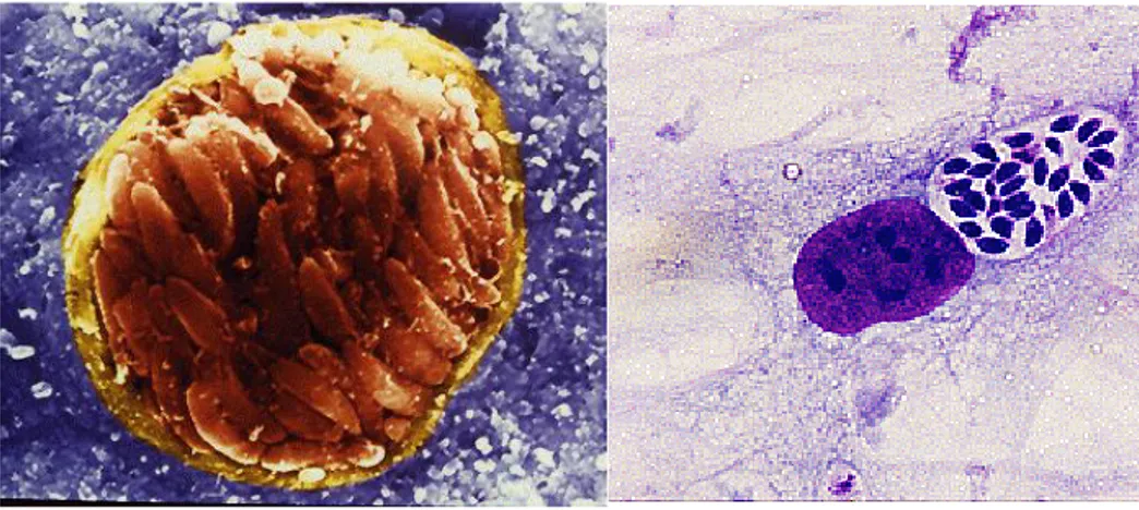 Fig. 2 On the left: tissue cyst with many bradyzoites within the brain of an infected mouse (scanning  electron micrograph  (http://cmgm.stanford.edu/micro/boothroyd/test.html) 