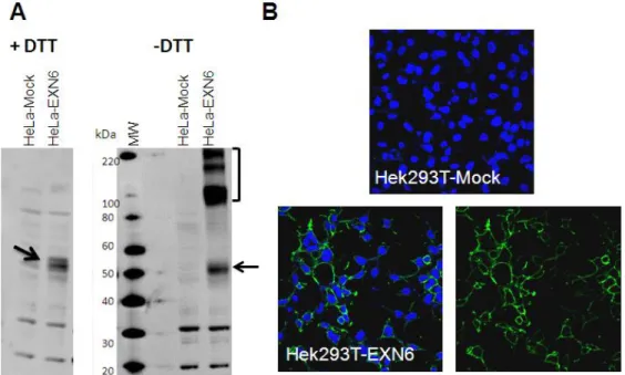 Figure 6 – Specificity of the IHC reactive anti-EXN6 polyclonal antibody.  Cells were transfected with a  EXN6-coding  plasmid  and  the  empty  vector  (mock)  and  subjected  to  WB  (A)  and  confocal  microscopy  (B)
