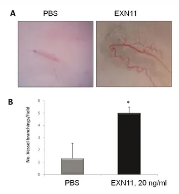 Figure 18. EXN11 stimulates vessel formation in the mouse matrigel sponge assay. 