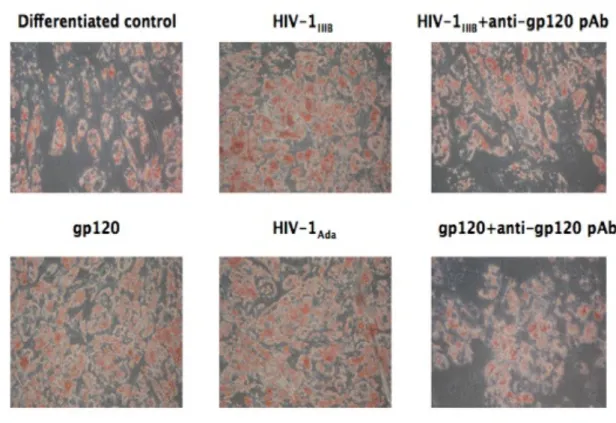 Figura 6 HIV e gp120 inducono un aumento nell’adipogenesi nelle MSC  Colorazione con Oil Red O di MSC differenziate non trattate, trattate con HIV-1 IIIB ,  con  virus  pretrattato  con  anticorpo  anti-gp120,  con  proteina  ricombinante  gp120,  con HIV-
