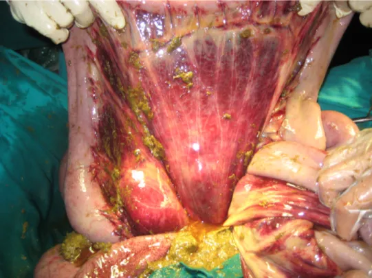 Fig. 3.1. Peritonite dovuta a rottura dell’intestino (foto DIMEVET)
