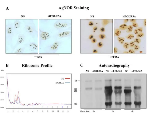 FIG. 3.2: Pol III inhibition cause nucleolar fragmentation and affects rRNA processing       A)AgNor staining of U2OS and HCT116 cells