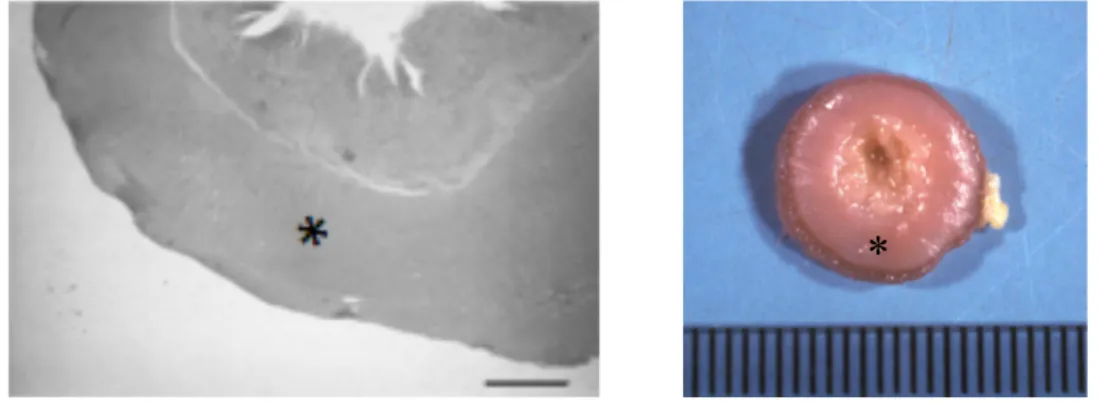 Figura  1.1  A  sinistra  immagine  microscopica  di  un’ansa  digiunale  in  sezione  trasversale  di  un  gatto  affetto  da  ipertrofia  idiopatica
