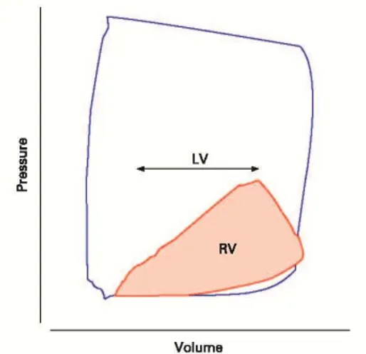 Fig. 3.5 Schematizzazione delle relazioni pressione-volume nel ventricolo sinistro (LV) e nel ventricolo  destro (RV) in condizioni fisiologiche