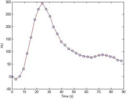 Figure 2: An example of Time attenuation curve  (TAC). This curve has been obtained positioning a ROI (Region of interest)  on aorta