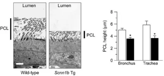 Figura 5.  Effetto dell’overespressione del gene Scnn1B nei topi sull’altezza del liquido periciliare (PCL)   (Mall et al