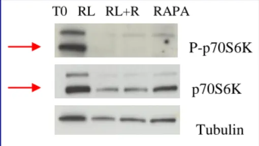 Fig.  29:  Expression  of  total  and  phosphorilated  form  of  S6K1  kinase.  Cells  were  treated  with  rapamycin  (10nM)  before  the  irradiation.Tubulin  is  used  as  a  loading  control