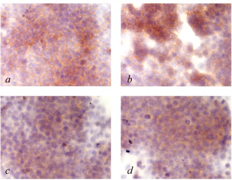 Figura 6:  Immunoistochimica di EGFR (a,b) ed EGFR fosforilato (c,d) in cellule  non trattate (a,c) e trattate con CRM197 (b,d).