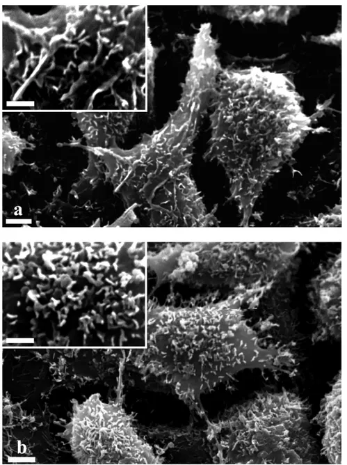 Figura 7: Microscopia elettronica a scansione (SEM) di cellule non trattate (a) e  trattate con CRM197 (b), a 4000 e 8000 ingrandimenti.