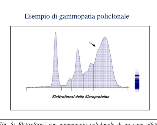 Fig.  5:  Elettroforesi  con  gammopatia  policlonale  di  un  cane  affetto  da  leishmaniosi  incluso  nel  nostro  studio