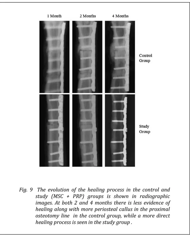 Fig.	
   9	
   	
   The	
   evolution	
   of	
   the	
   healing	
   process	
   in	
   the	
   control	
   and	
   study	
   (MSC	
   +	
   PRP)	
   groups	
   is	
   shown	
   in	
   radiographic	
   images.	
   At	
   both	
   2	
   and	
   4	
   months