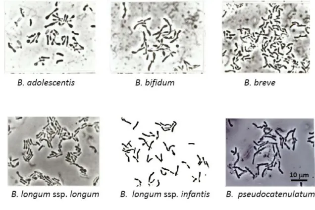 Figure 14 Bifidobacterium species predominat in infant microbiota 
