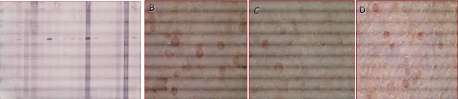 Figura  3.3  Western  Blotting  con  estratto  proteico  di  cellule  Sf9  infettate  (K+)  e  non  infette  (K-),  immuno-colorato con sieri policlonali murini (A) e con siero suino positivo per HEV (B) 
